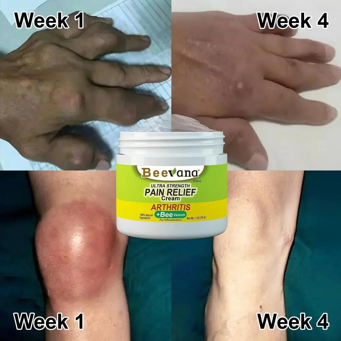 Bee Venom Joint and Bone Therapy Cream - ( Buy 1 get 2 Free )