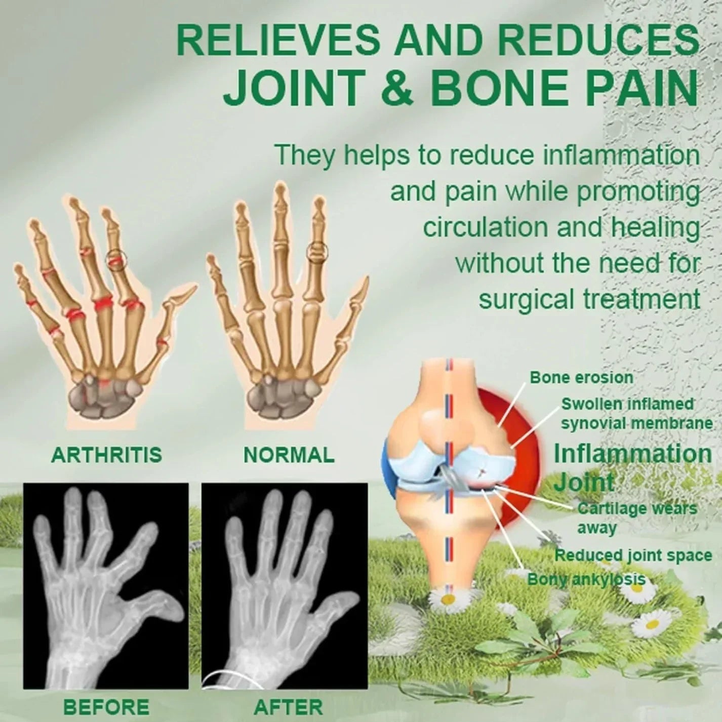 Bee Venom Joint and Bone Therapy Cream - ( Buy 1 get 2 Free )