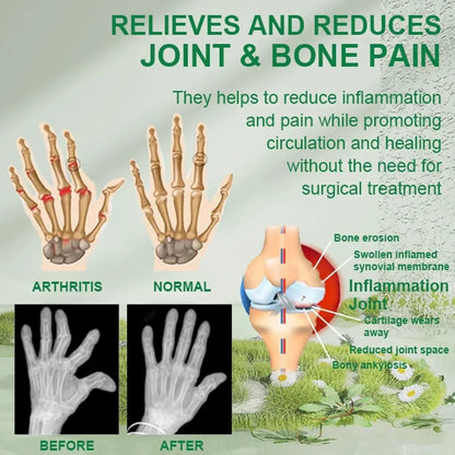 Bee Venom Joint and Bone Therapy Cream - ( Buy 1 get 2 Free )